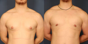 Before and After Image