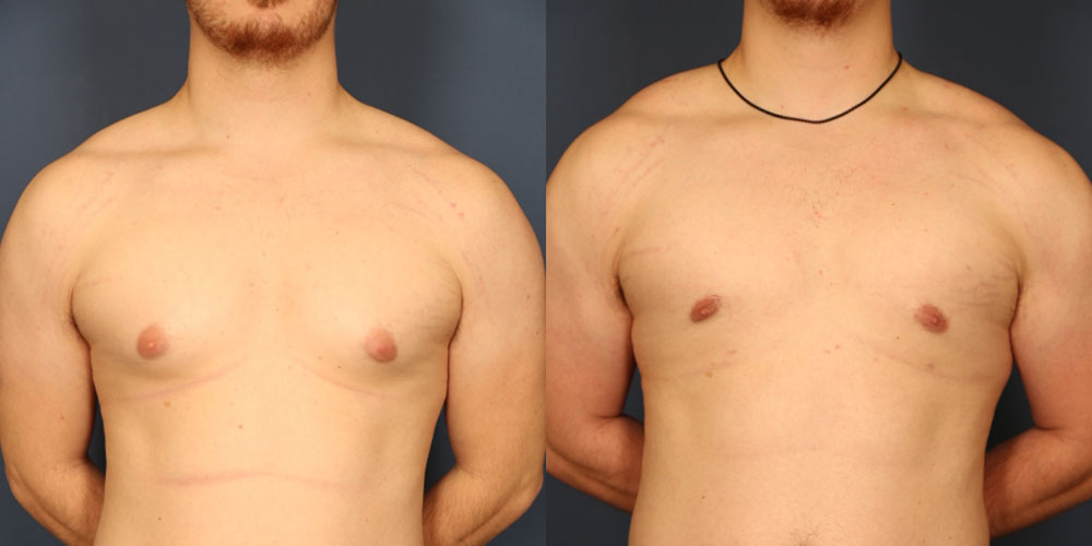 Before and After Image