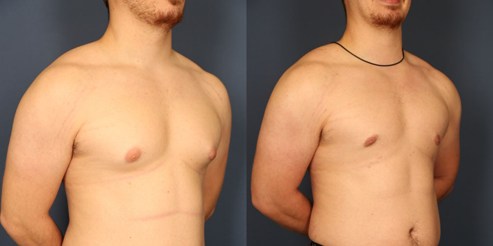 Before and After Image