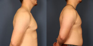 Before and After Image