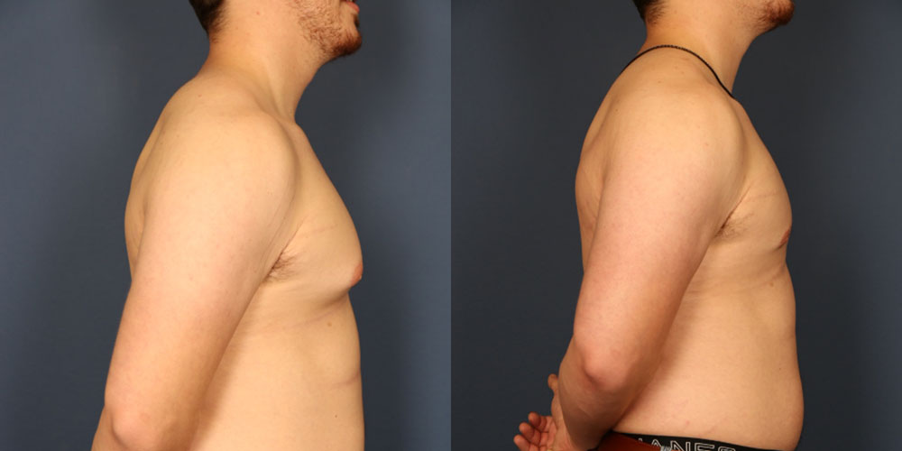 Before and After Image