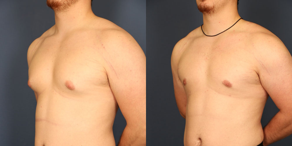 Before and After Image