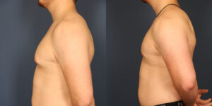 Before and After Image