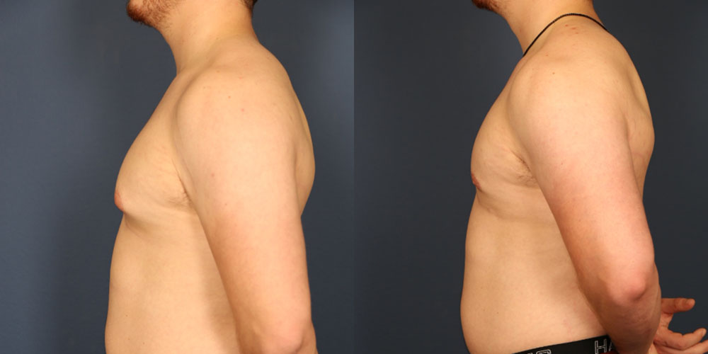 Before and After Image