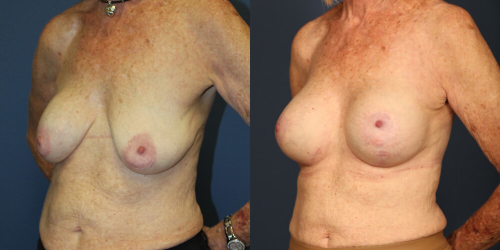 Before and After Image