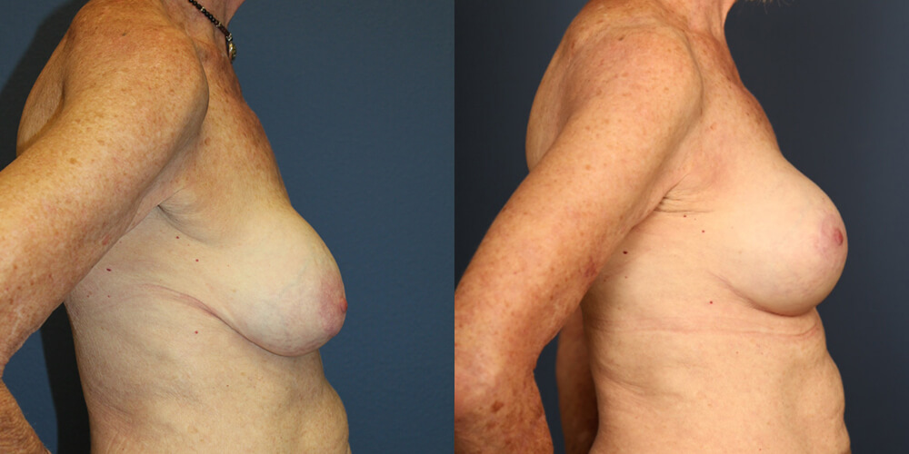 Before and After Image