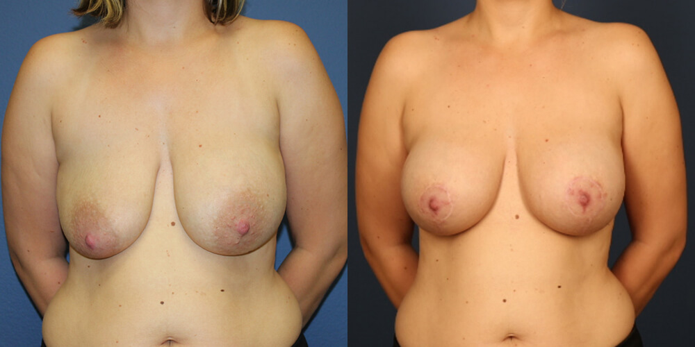 Before and After Image