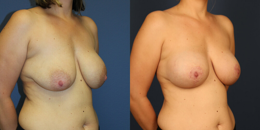 Before and After Image