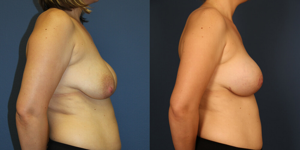 Before and After Image