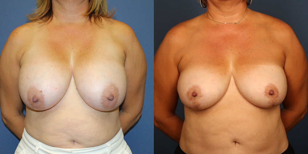 Before and After Image