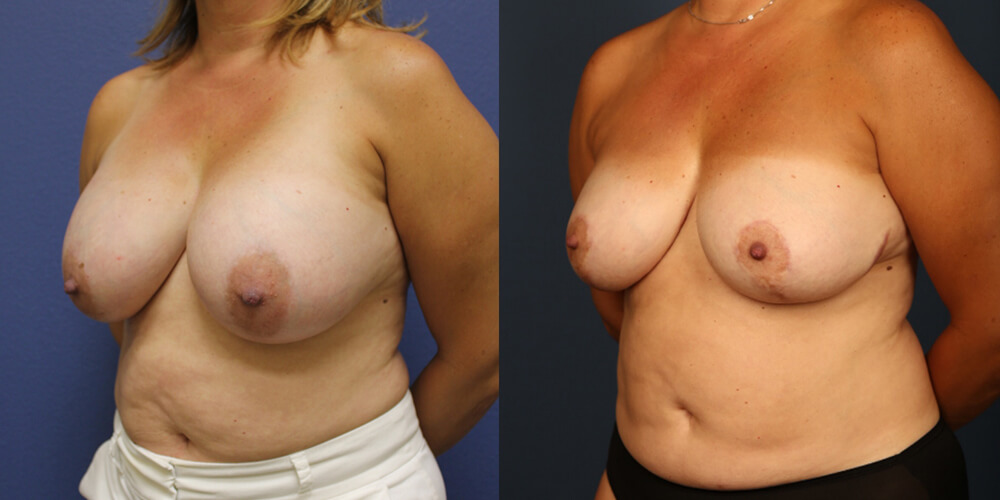 Before and After Image