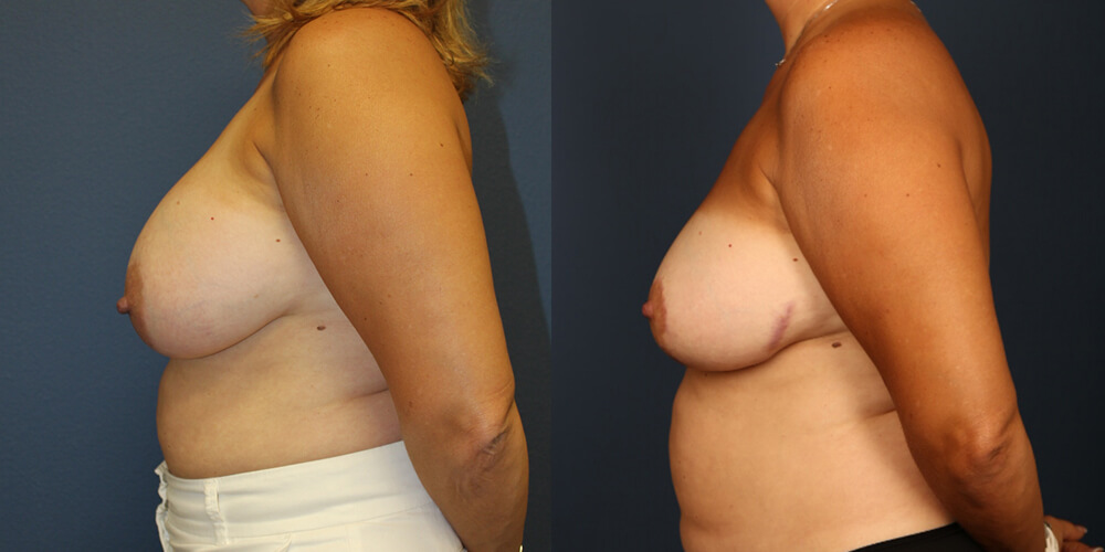 Before and After Image