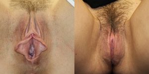 Before and After Image