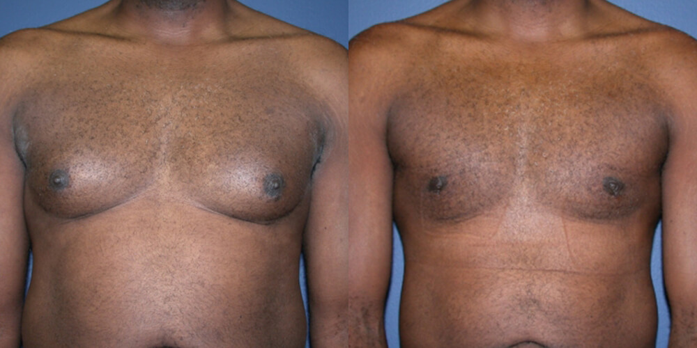 Before and After Image