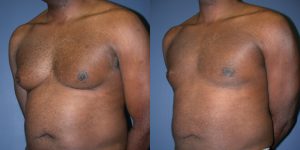 Before and After Image