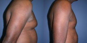 Before and After Image