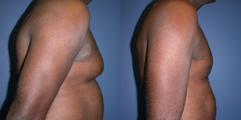 Before and After Image