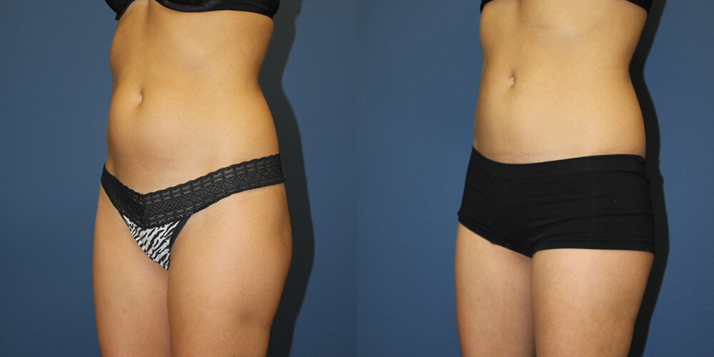 Before and After Image