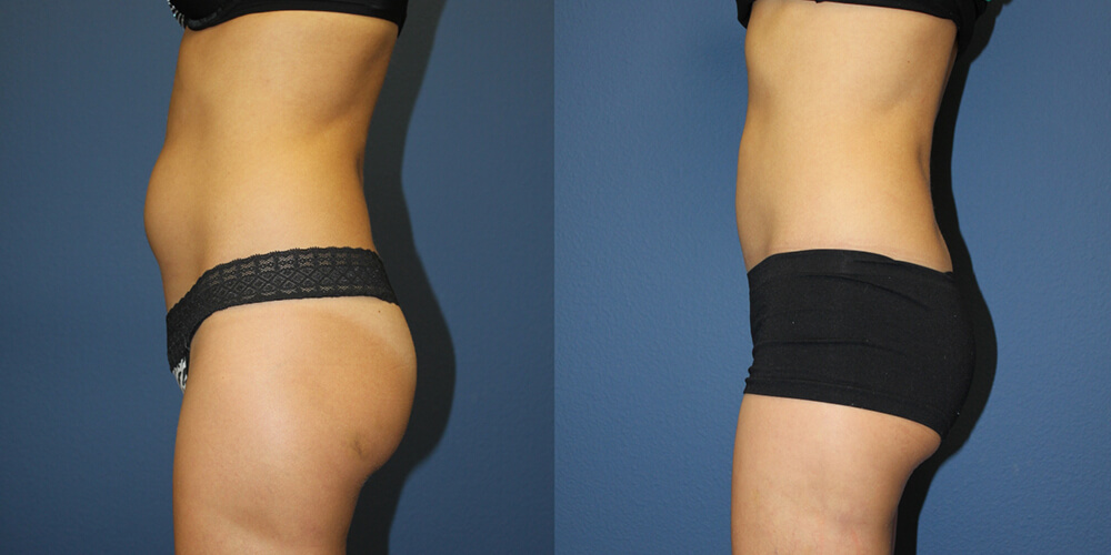 Before and After Image