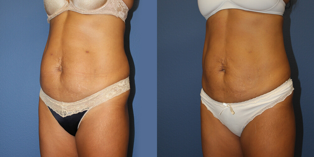 Before and After Image