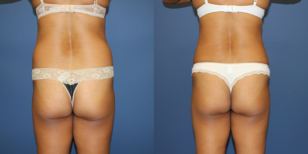 Before and After Image