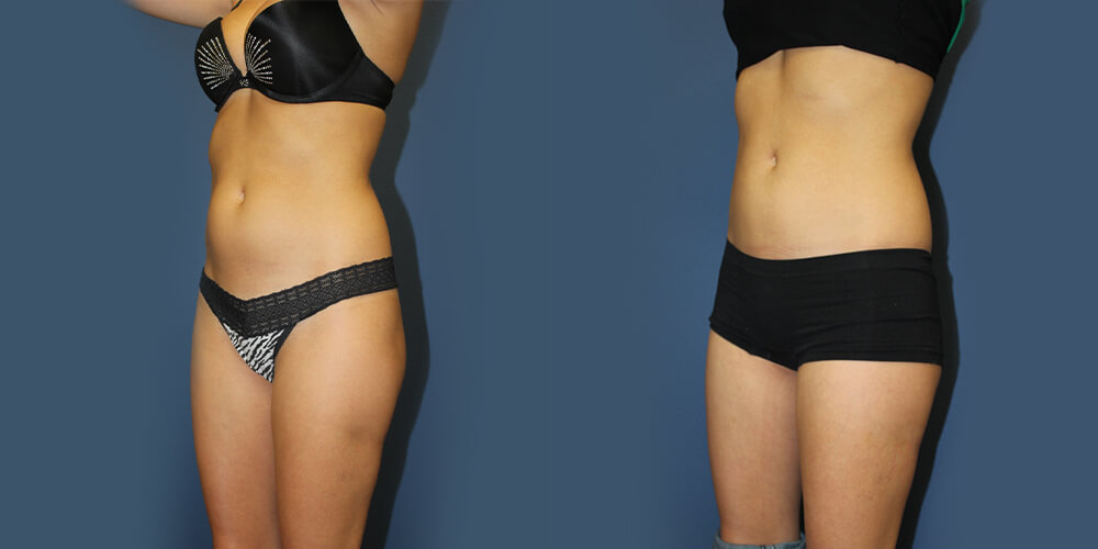 Before and After Image