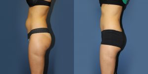 Before and After Image