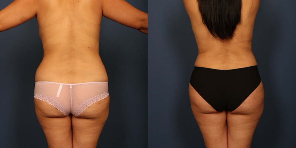 Before and After Image