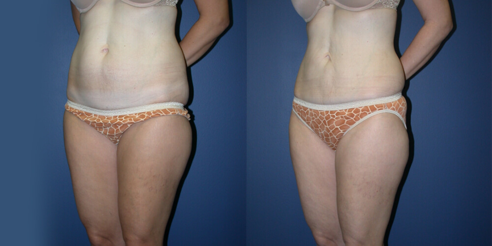 Before and After Image