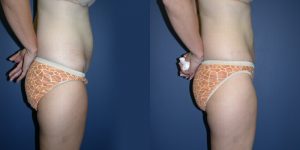 Before and After Image