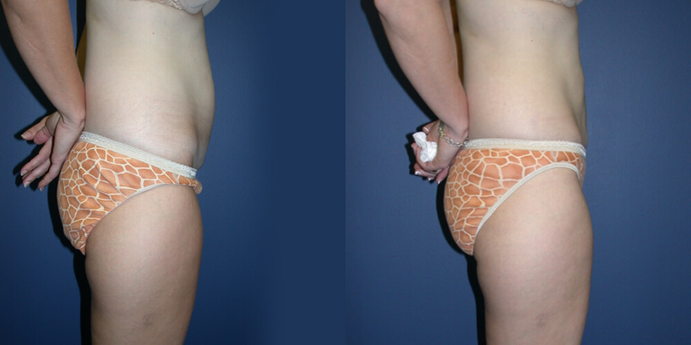 Before and After Image