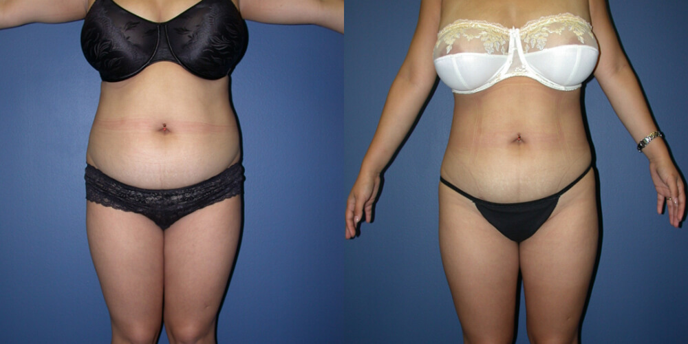 Before and After Image