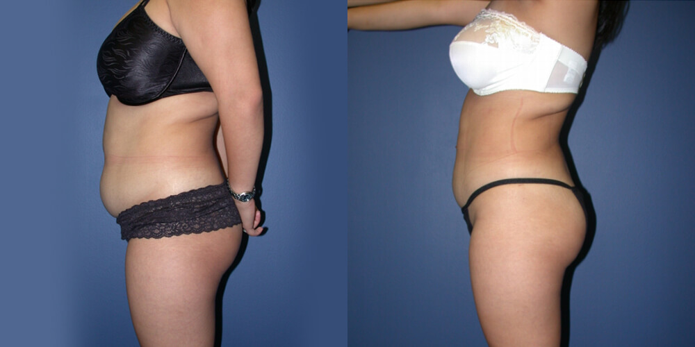 Before and After Image