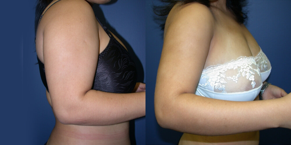 Before and After Image