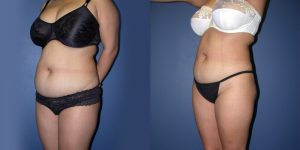 Before and After Image