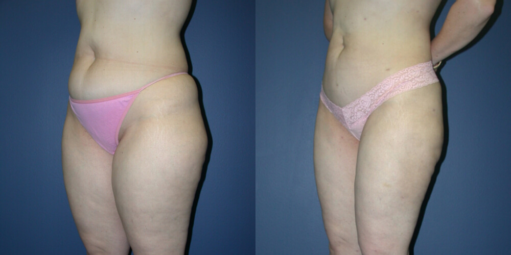 Before and After Image