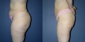 Before and After Image