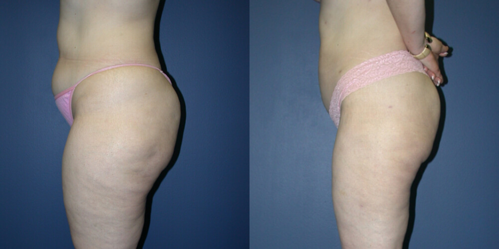 Before and After Image