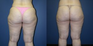 Before and After Image