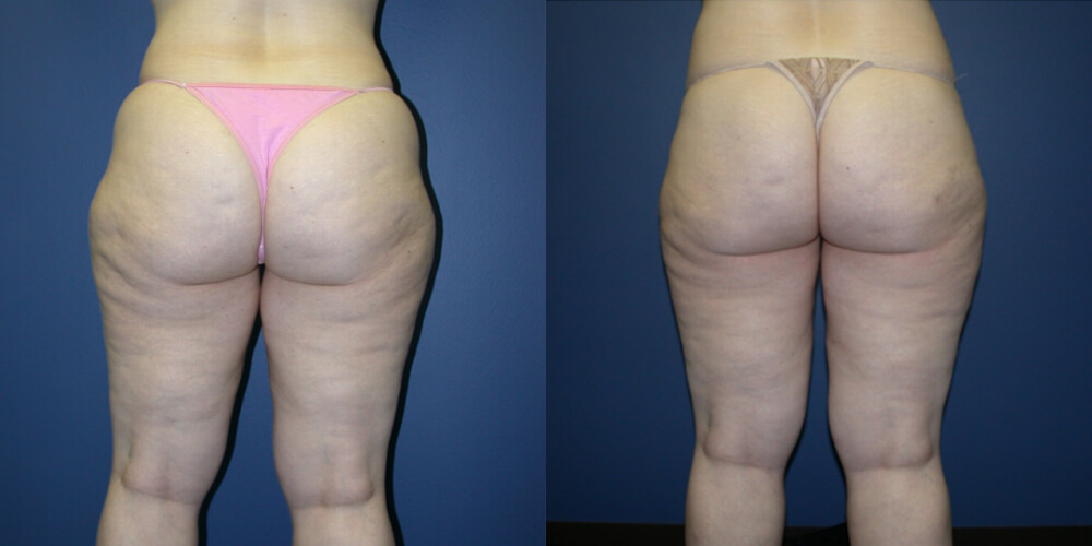 Before and After Image