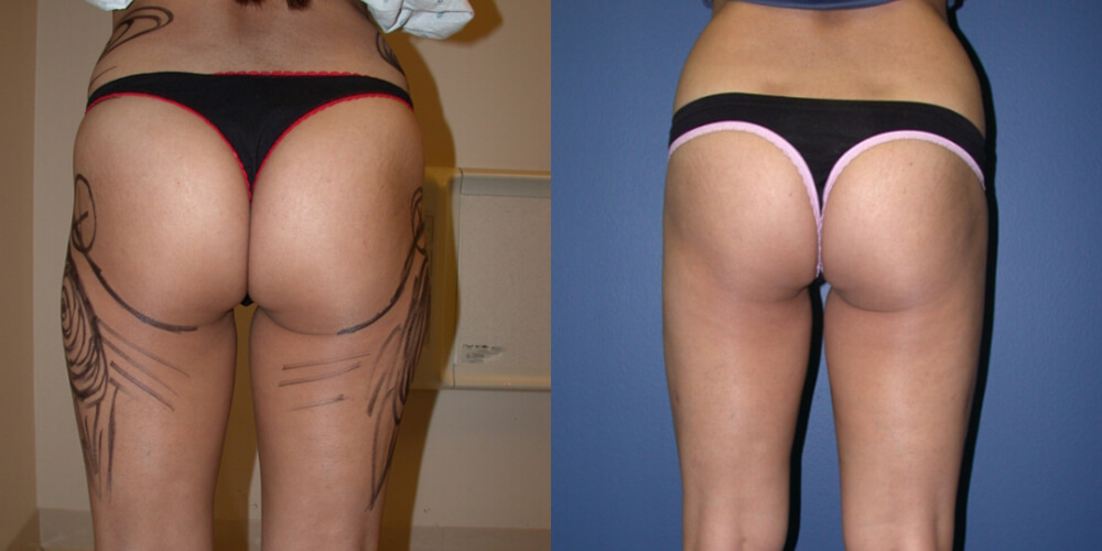 Before and After Image