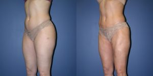 Before and After Image