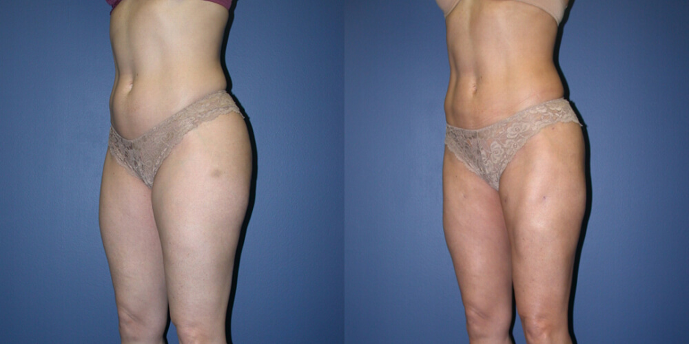 Before and After Image