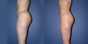 Before and After Image