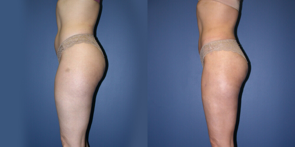 Before and After Image