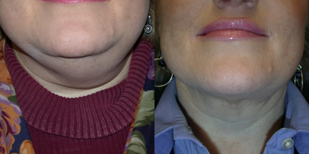 Before and After Image