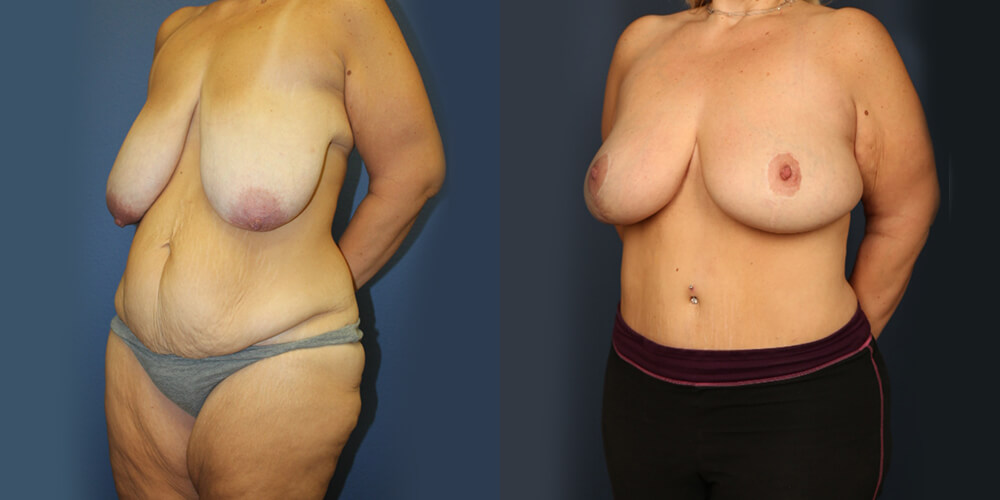 Before and After Image