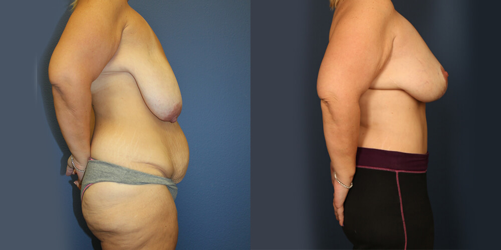 Before and After Image