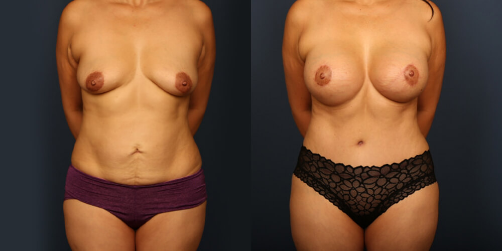 Before and After Image