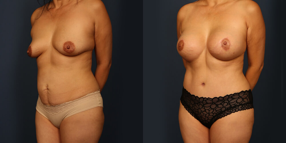 Before and After Image